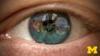 Introduction to Cataract Surgery