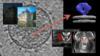Image and Video Processing: From Mars to Hollywood with a Stop at the Hospital