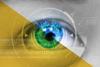 Robotic Vision